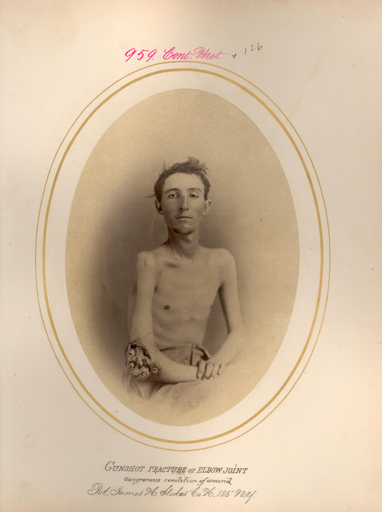 Rare fusil Springfield 1861 de Cadet - Colt Hartford en 1862 - Cal .58 à canon rayé pour balle Minié - Mécanique, marquages et canon plus qu'excellents - Bretelle - Superbe !  TBE++ – Image 33